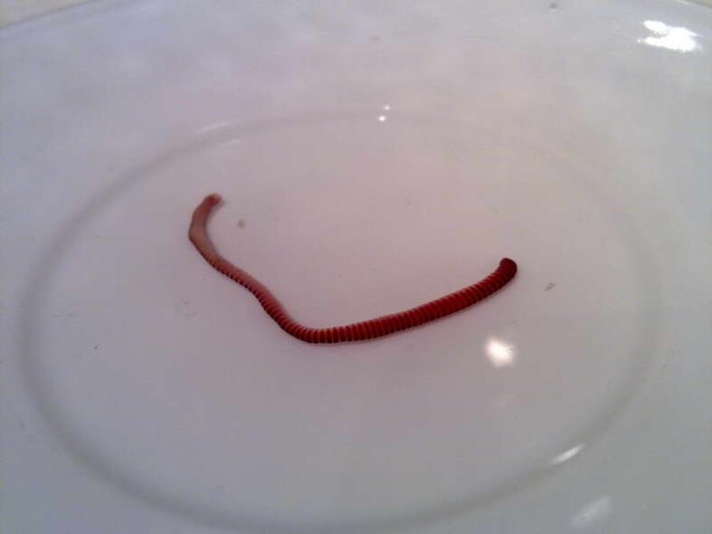 parasites from the human body