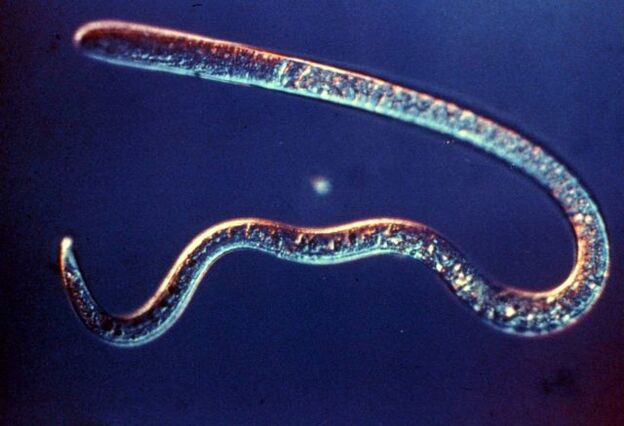 trichinella from the human organism