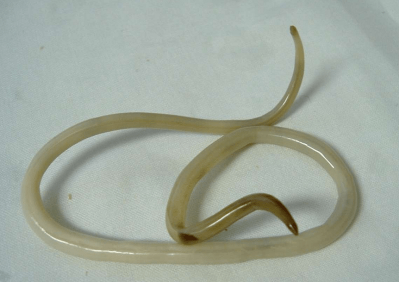 worms from the human body and its treatment